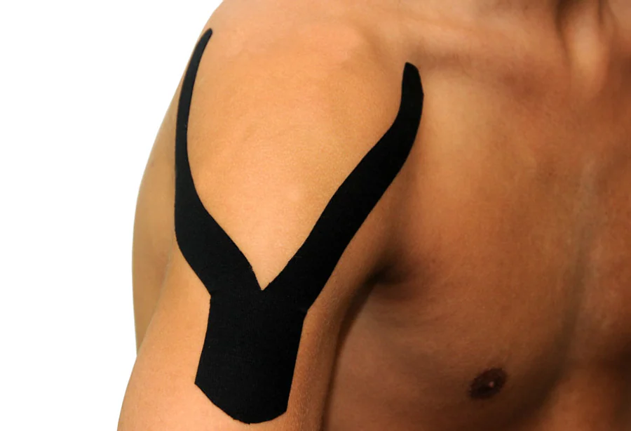 Zwarte Dream K kinesiotape in een Y-vorm over bovenarm en schouder