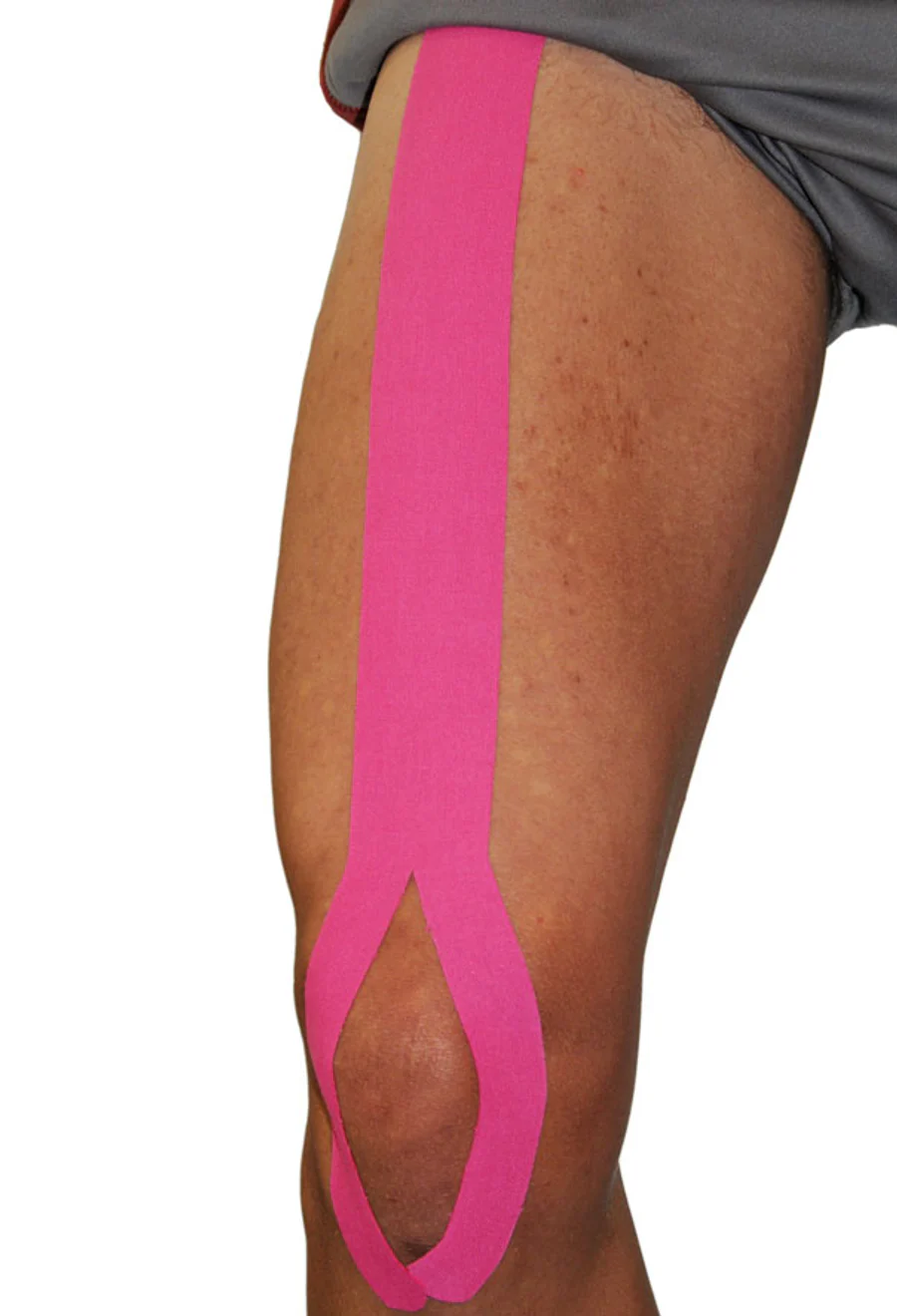 Roze Dream K kinesiotape vanaf het bovenbeen rond de knie