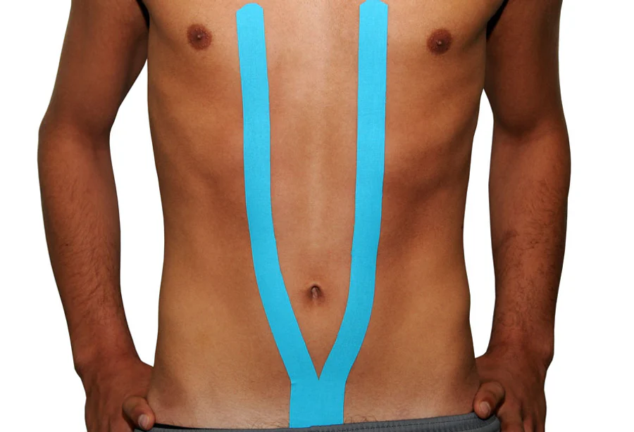 Blauwe Dream K kinesiotape in een lange Y-vorm op buik en borstkas