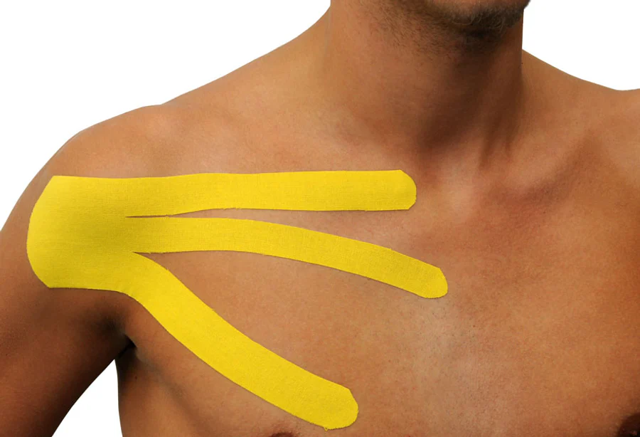 Gele Dream K kinesiotape in drie stroken aan de voorzijde van de schouder