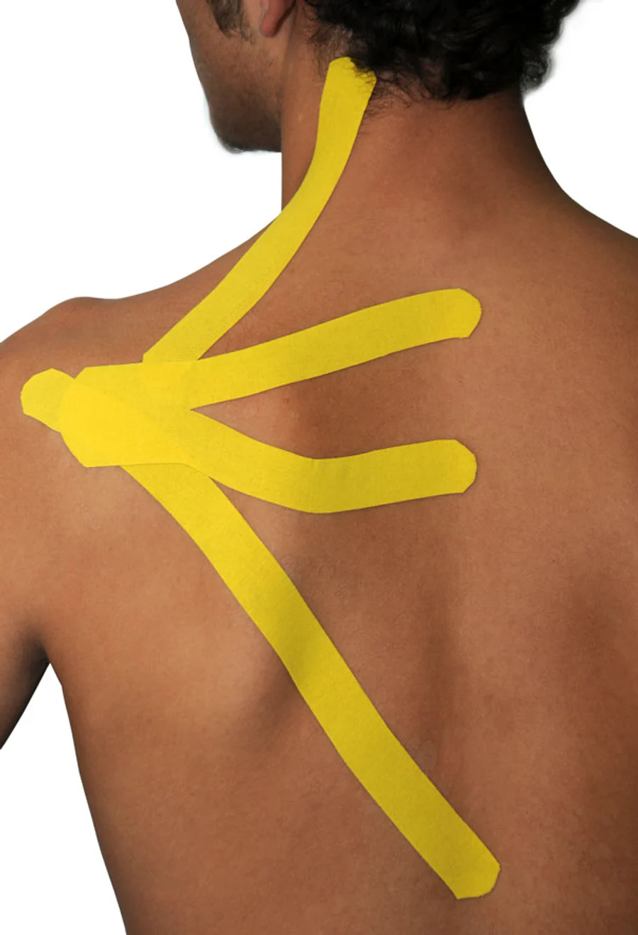 Gele Dream K kinesiotape in meerdere stroken over schouderblad, rug en hals